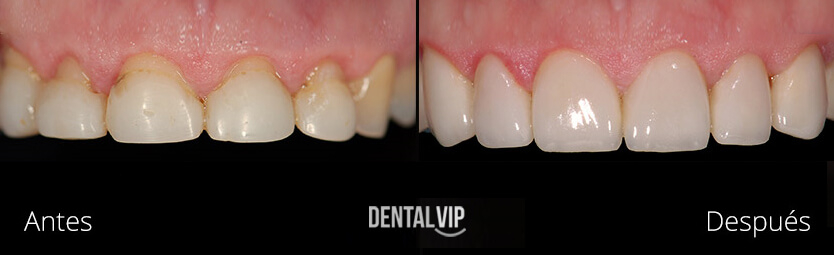 DentalVip