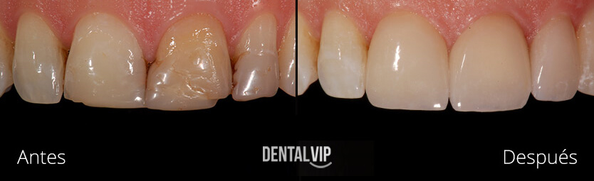 DentalVip