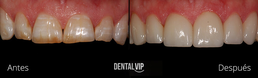 DentalVip