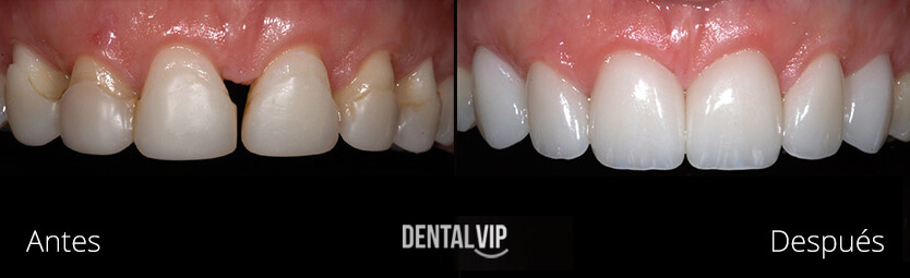 DentalVip