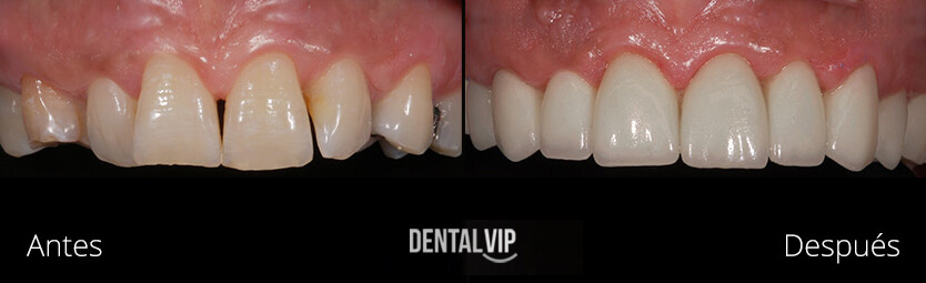 DentalVip