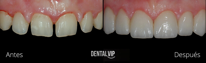 DentalVip