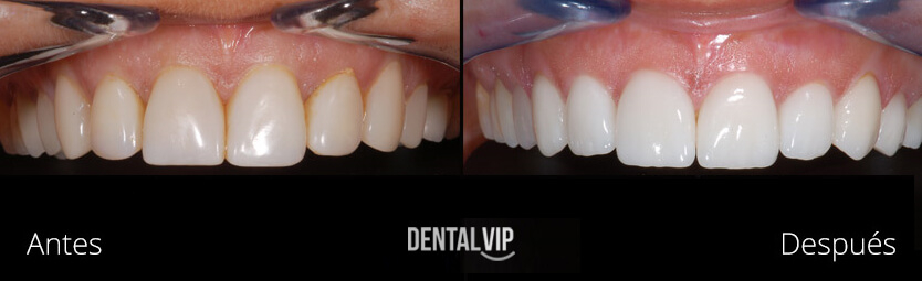 DentalVip