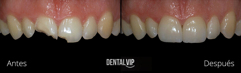 DentalVip